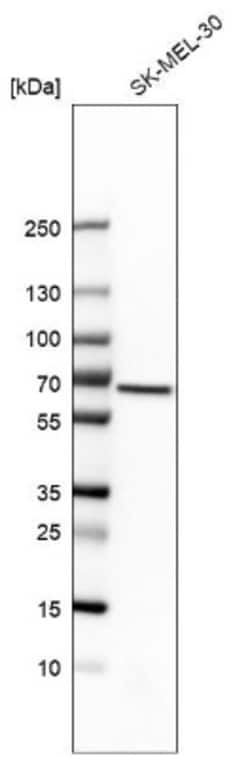 Mucolipin 1 Antibody, Novus Biologicals 0.1mL; Unlabeled:Antibodies, Polyclonal