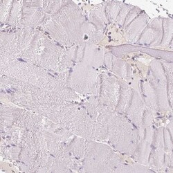 Mucolipin 3 Antibody, Novus Biologicals 0.1mL; Unlabeled:Antibodies, Polyclonal