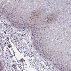 Mus81 Antibody, Novus Biologicals 0.1mL; Unlabeled:Antibodies, Polyclonal