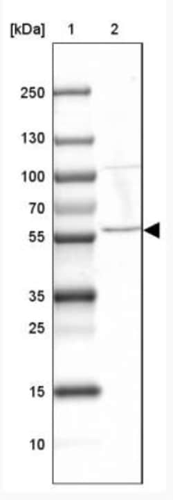 Mus81 Antibody, Novus Biologicals 0.1mL; Unlabeled:Antibodies, Polyclonal