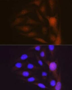 Musashi-1 Rabbit anti-Human, Mouse, Clone: 9S7Y1, Novus Biologicals 100 &mu;g | Buy Online | Novus Biologicals | Fisher Scientific