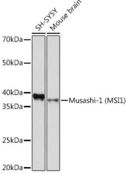 Musashi-1 Rabbit anti-Human, Mouse, Clone: 9S7Y1, Novus Biologicals 100 &mu;g | Buy Online | Novus Biologicals | Fisher Scientific