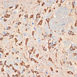 Musashi-2 Rabbit anti-Human, Mouse, Rat, Clone: 7L4E9, Novus Biologicals:Antibodies:Primary