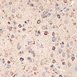 Musashi-2 Rabbit anti-Human, Mouse, Rat, Clone: 7L4E9, Novus Biologicals:Antibodies:Primary