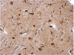 Musashi-2 Antibody, Novus Biologicals 0.1mL; Unlabeled:Antibodies, Polyclonal