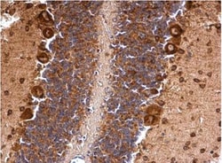 Musashi-2 Antibody, Novus Biologicals 0.1mL; Unlabeled:Antibodies, Polyclonal