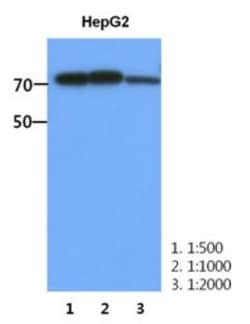 Muscle Phosphofructokinase/PFKM/PFK-1 Antibody (2F11) - BSA Free, Novus