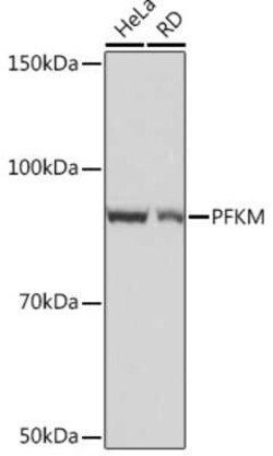 Muscle Phosphofructokinase/PFKM/PFK-1 Rabbit anti-Human, Mouse, Rat, Clone: