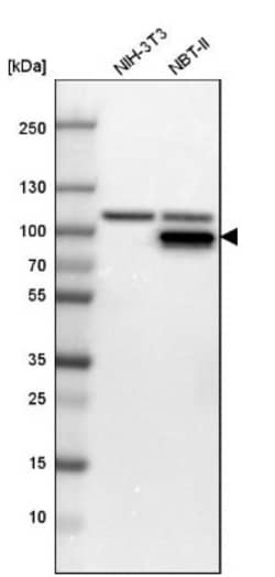 Muscle Phosphofructokinase/PFKM/PFK-1 Antibody, Novus Biologicals 0.1mL;