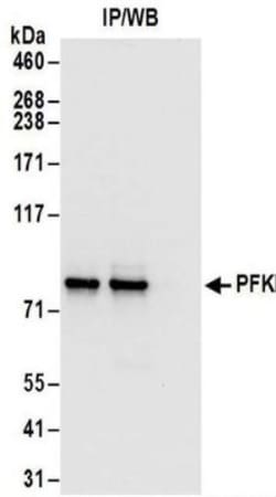 Muscle Phosphofructokinase/PFKM/PFK-1 Antibody, Novus Biologicals 0.1mg;