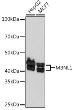 Muscleblind-like 1 Rabbit anti-Human, Clone: 7N6W3, Novus Biologicals 20