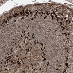 MxA/Mx1 Antibody, Novus Biologicals 25 &mu;L; Unlabeled:Antibodies, Polyclonal