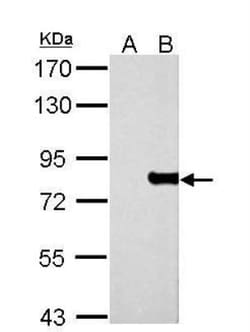 MxA/Mx1 Antibody, Novus Biologicals 0.1mg; Unlabeled:Antikörper