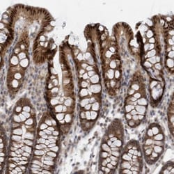 Mxi1 Antibody, Novus Biologicals 25 &mu;L | Buy Online | Novus Biologicals | Fisher Scientific