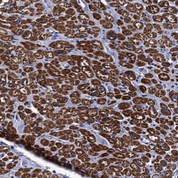 MyBPC3 Antibody, Novus Biologicals:Antibodies:Primary Antibodies