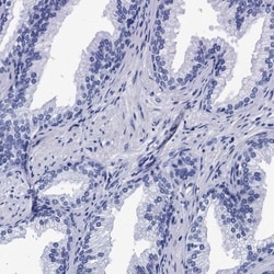 MyBPC3 Antibody, Novus Biologicals:Antibodies:Primary Antibodies