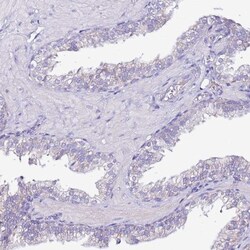 MyBPC3 Antibody, Novus Biologicals 0.1mL; Unlabeled:Antibodies, Polyclonal