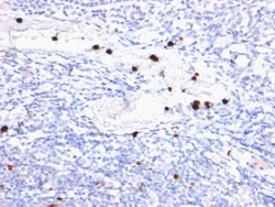 Myeloid-Associated Differentiation Marker Antibody (MYADM/972), Novus Biologicals