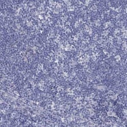 Myeloid leukemia factor 1 Rabbit anti-Human, Polyclonal, Novus Biologicals