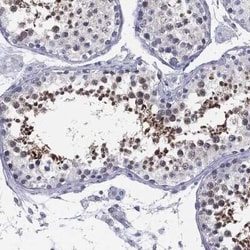 Myeloid leukemia factor 1 Rabbit anti-Human, Polyclonal, Novus Biologicals