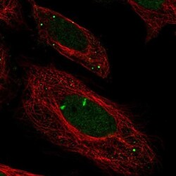 Myeloperoxidase/MPO Antibody, Novus Biologicals 0.1mL; Unlabeled:Antibodies,