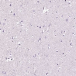 Myeloperoxidase/MPO Antibody, Novus Biologicals 0.1mL; Unlabeled:Antibodies,