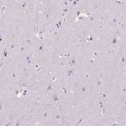Myeloperoxidase/MPO Antibody, Novus Biologicals 0.1mL; Unlabeled:Antibodies,