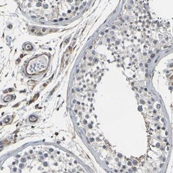 Myoferlin Antibody, Novus Biologicals:Antibodies:Primary Antibodies