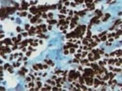 Myogenin Antibody (5FD) - BSA Free, Novus Biologicals 0.025mg; Unlabeled:Antibodies,