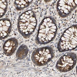 Myomegalin Antibody, Novus Biologicals 0.1mL; Unlabeled:Antibodies, Polyclonal