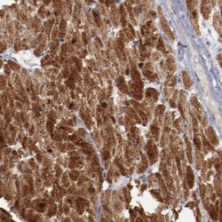 Myomesin 2 Antibody, Novus Biologicals 25 &mu;L | Buy Online | Novus Biologicals | Fisher Scientific
