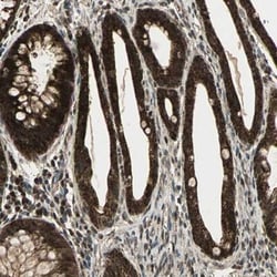 Myomesin 2 Antibody, Novus Biologicals 25 &mu;L; Unlabeled:Antibodies,