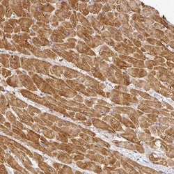 Myomesin 2 Antibody, Novus Biologicals 25 &mu;L; Unlabeled:Antibodies,