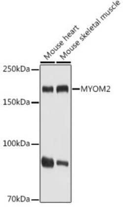 Myomesin 2 Rabbit anti-Human, Mouse, Rat, Polyclonal, Novus Biologicals