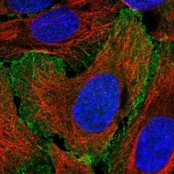 Myosin 1B Antibody, Novus Biologicals 0.1mL; Unlabeled:Antibodies, Polyclonal