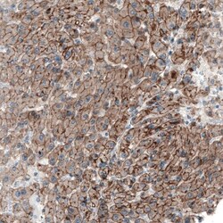 Myosin 1B Antibody, Novus Biologicals:Antibodies:Primary Antibodies