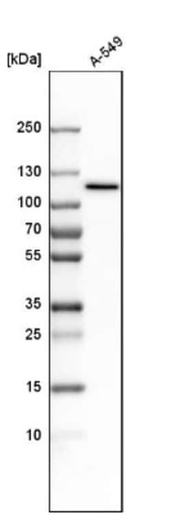 Myosin 1C Antibody, Novus Biologicals 0.1mL; Unlabeled:Antibodies, Polyclonal