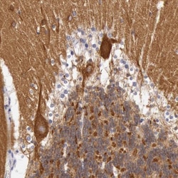 Myosin 5a Antibody, Novus Biologicals 25 &mu;L, Unconjugated:Antibodies,