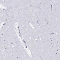 Myosin IF Antibody, Novus Biologicals:Antibodies:Primary Antibodies