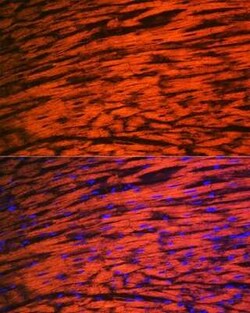 Myosin Light Chain 2 Rabbit anti-Mouse, Rat, Clone: 5M6Q8, Novus Biologicals:Antibodies:Primary