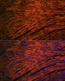 Myosin Light Chain 2 Rabbit anti-Mouse, Rat, Clone: 5M6Q8, Novus Biologicals:Antibodies:Primary