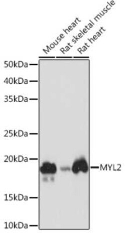 Myosin Light Chain 2 Rabbit anti-Mouse, Rat, Clone: 5M6Q8, Novus Biologicals:Antibodies:Primary