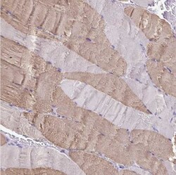 Myosin Light Chain 2 Antibody, Novus Biologicals 25 &mu;L; Unlabeled:Antibodies,