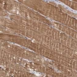 Myosin Phosphatase 2 Antibody, Novus Biologicals 0.1mL; Unlabeled:Antibodies,