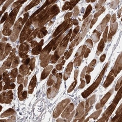 Myosin Phosphatase 2 Antibody, Novus Biologicals 25 &mu;L | Buy Online | Novus Biologicals | Fisher Scientific