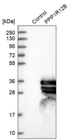 Myosin Phosphatase 2 Antibody, Novus Biologicals 25 &mu;L | Buy Online | Novus Biologicals | Fisher Scientific