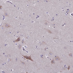 Myosin VB Antibody, Novus Biologicals 0.1mL; Unlabeled:Antibodies, Polyclonal