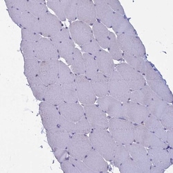 Myosin VB Antibody, Novus Biologicals 0.1mL; Unlabeled:Antibodies, Polyclonal