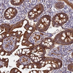 Myosin VB Antibody, Novus Biologicals 0.1mL; Unlabeled:Antibodies, Polyclonal