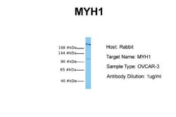 Myosin Heavy Chain 1 Antibody, Novus Biologicals 0.05mg; Unlabeled:Antibodies,